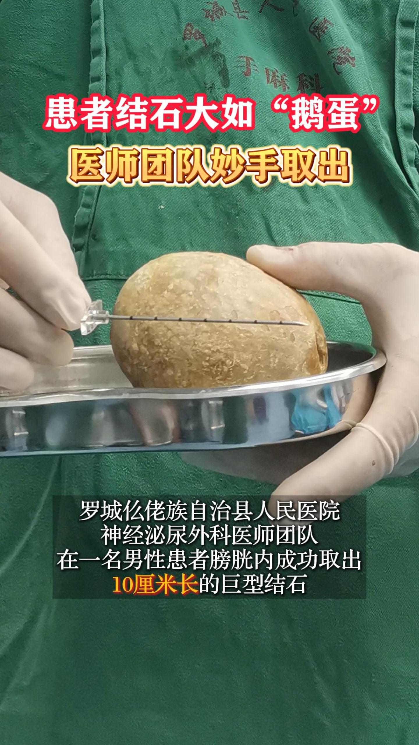 ���߽�ʯ���硰�쵰����ҽʦ�Ŷ�����ȡ��